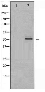 EPOR / EPO Receptor Antibody - Western blot of Epo-R phosphorylation expression in K562 whole cell lysates,The lane on the left is treated with the antigen-specific peptide.