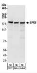 EPRS / PARS Antibody - Detection of Human EPRS by Western Blot. Samples: Whole cell lysate (50 ug) from 293T, HeLa, and Jurkat cells. Antibodies: Affinity purified rabbit anti-EPRS antibody used for WB at 0.1 ug/ml. Detection: Chemiluminescence with an exposure time of 10 seconds.