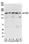EPRS / PARS Antibody - Detection of Human and Mouse EPRS by Western Blot. Samples: Whole cell lysate (50 ug) from 293T, HeLa, Jurkat, mouse TCMK-1, and mouse NIH3T3 cells. Antibodies: Affinity purified rabbit anti-EPRS antibody used for WB at 0.1 ug/ml. Detection: Chemiluminescence with an exposure time of 10 seconds.