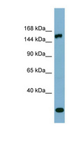 EPRS / PARS Antibody - EPRS antibody Western blot of PANC1 cell lysate. This image was taken for the unconjugated form of this product. Other forms have not been tested.