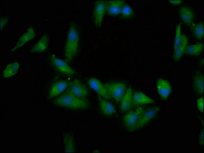 EPRS / PARS Antibody - Immunofluorescence staining of Hela cells at a dilution of 1:200, counter-stained with DAPI. The cells were fixed in 4% formaldehyde, permeabilized using 0.2% Triton X-100 and blocked in 10% normal Goat Serum. The cells were then incubated with the antibody overnight at 4 °C.The secondary antibody was Alexa Fluor 488-congugated AffiniPure Goat Anti-Rabbit IgG (H+L) .