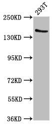 EPRS / PARS Antibody - Positive Western Blot detected in 293T whole cell lysate. All lanes: EPRS antibody at 7.4 µg/ml Secondary Goat polyclonal to rabbit IgG at 1/50000 dilution. Predicted band size: 171 KDa. Observed band size: 171 KDa