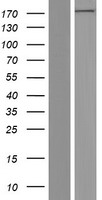 EPRS / PARS Protein - Western validation with an anti-DDK antibody * L: Control HEK293 lysate R: Over-expression lysate