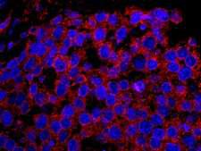 EPS15 Antibody - Detection of Human EPS15 by IHC-IF. Sample: FFPE section of human testicular seminoma. Antibody: Affinity purified rabbit anti-EPS15 used at a dilution of 1:100. Detection: Red-fluorescent goat anti-rabbit IgG highly cross-adsorbed Antibody Hilyte Plus 555 (A120-501E) used at a dilution of 1:100.