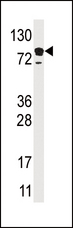 EPS15 Antibody - Western blot of anti-EPS15 antibody in HL60 cell line lysate (35 ug/lane). EPS15 (arrow) was detected using the purified antibody.