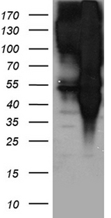 EPS15 Antibody - HEK293T cells were transfected with the pCMV6-ENTRY control. (Left lane) or pCMV6-ENTRY EPS15. (Right lane) cDNA for 48 hrs and lysed