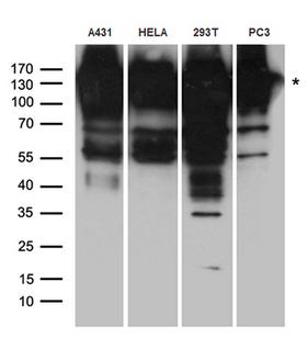 EPS15 Antibody - Western blot analysis of extracts. (35ug) from different cell lines and tissues by using anti-EPS15 rabbit polyclonal antibody.