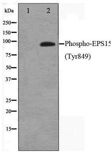 EPS15 Antibody - Western blot of HepG2 cell lysate using Phospho-EPS15(Tyr849) Antibody