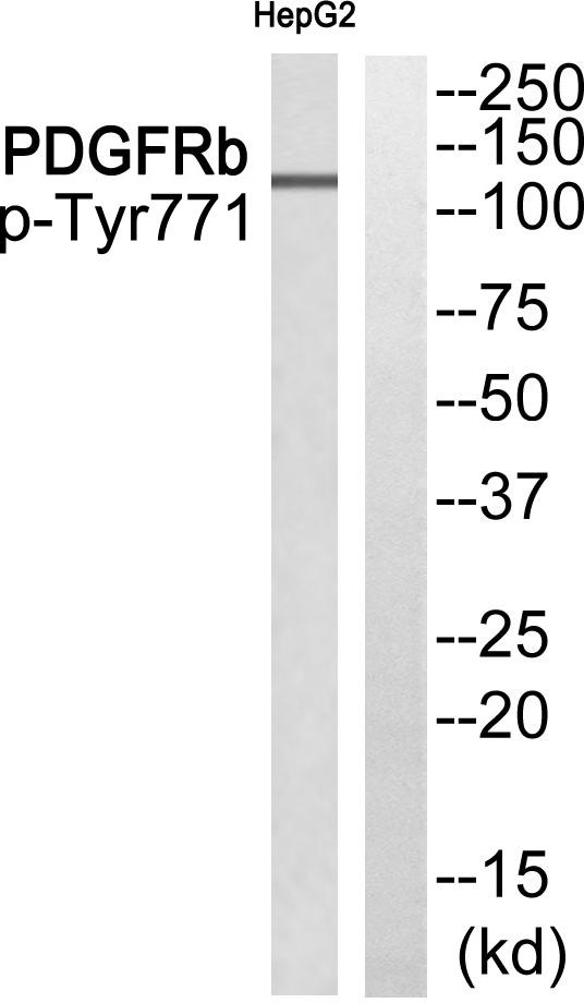 EPS15 Antibody - Western blot analysis of extracts from HepG2 cells, using EPS15 (Phospho-Tyr849) antibody.