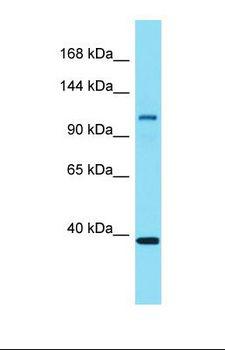 EPS15L1 / EPS15R Antibody - Western blot of Mouse Spleen. Eps15l1 antibody dilution 1.0 ug/ml.  This image was taken for the unconjugated form of this product. Other forms have not been tested.