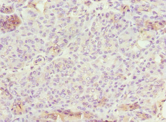 EPS15L1 / EPS15R Antibody - Immunohistochemistry of paraffin-embedded human pancreatic tissue at dilution 1:100