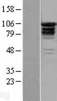 EPS15L1 / EPS15R Protein - Western validation with an anti-DDK antibody * L: Control HEK293 lysate R: Over-expression lysate