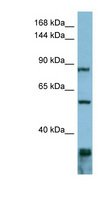 EPS8 Antibody - EPS8 antibody Western blot of ACHN lysate. This image was taken for the unconjugated form of this product. Other forms have not been tested.