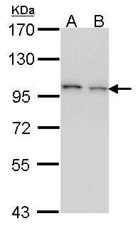EPS8 Antibody - Sample (30 ug of whole cell lysate). A: H1299, B: Hela. 7.5% SDS PAGE. EPS8 antibody. EPS8 antibody diluted at 1:1000.