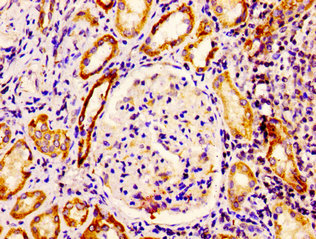 EPS8 Antibody - Immunohistochemistry image at a dilution of 1:400 and staining in paraffin-embeddedhuman kidney tissue performed on a Leica BondTM system. After dewaxing and hydration, antigen retrieval was mediated by high pressure in a citrate buffer (pH 6.0) . Section was blocked with 10% normal goat serum 30min at RT. Then primary antibody (1% BSA) was incubated at 4 °C overnight. The primary is detected by a biotinylated secondary antibody and visualized using an HRP conjugated ABC system.