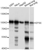 EPS8 Antibody - Western blot analysis of extracts of various cell lines, using EPS8 antibody at 1:1000 dilution. The secondary antibody used was an HRP Goat Anti-Rabbit IgG (H+L) at 1:10000 dilution. Lysates were loaded 25ug per lane and 3% nonfat dry milk in TBST was used for blocking. An ECL Kit was used for detection and the exposure time was 1s.