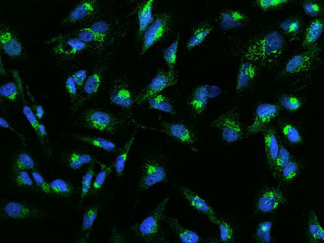 EPS8 Antibody - Immunofluorescence staining of EPS8 in U251MG cells. Cells were fixed with 4% PFA, permeabilzed with 0.1% Triton X-100 in PBS, blocked with 10% serum, and incubated with rabbit anti-Human EPS8 polyclonal antibody (dilution ratio 1:200) at 4°C overnight. Then cells were stained with the Alexa Fluor 488-conjugated Goat Anti-rabbit IgG secondary antibody (green) and counterstained with DAPI (blue). Positive staining was localized to Cytoplasm.