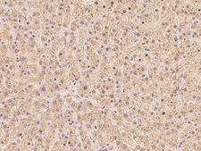 EPS8 Antibody - Immunochemical staining of human EPS8 in human liver with rabbit polyclonal antibody at 1:100 dilution, formalin-fixed paraffin embedded sections.