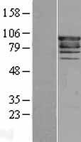 EPS8 Protein - Western validation with an anti-DDK antibody * L: Control HEK293 lysate R: Over-expression lysate