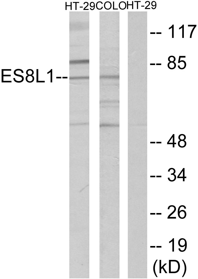 EPS8L1 Antibody - Western blot analysis of lysates from COLO205 and HT-29 cells, using ES8L1 Antibody. The lane on the right is blocked with the synthesized peptide.