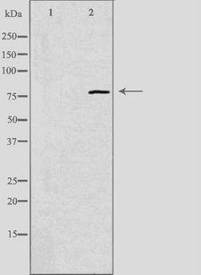EPS8L1 Antibody - Western blot analysis of extracts of COLO205 cells using ES8L1 antibody. The lane on the left is treated with the antigen-specific peptide.