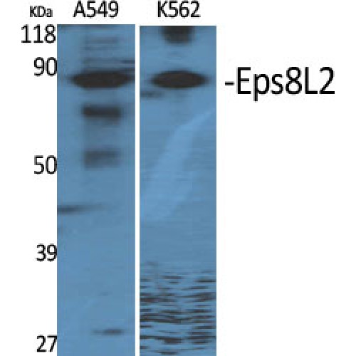 EPS8L2 Antibody - Western blot of Eps8L2 antibody