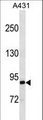EPS8L2 Antibody - EPS8L2 Antibody western blot of A431 cell line lysates (35 ug/lane). The EPS8L2 antibody detected the EPS8L2 protein (arrow).