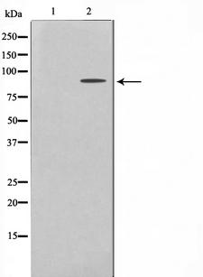 EPS8L2 Antibody - Western blot analysis on HeLa cell lysates using ES8L2 antibody. The lane on the left is treated with the antigen-specific peptide.