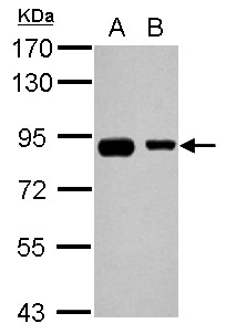 EPS8L2 Antibody - Sample (30 ug of whole cell lysate) A: A431 B: HepG2 7.5% SDS PAGE EPS8L2 antibody diluted at 1:1000