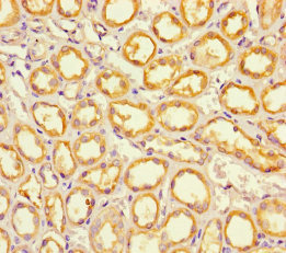 EPS8L2 Antibody - Immunohistochemistry of paraffin-embedded human kidney tissue using EPS8L2 Antibody at dilution of 1:100