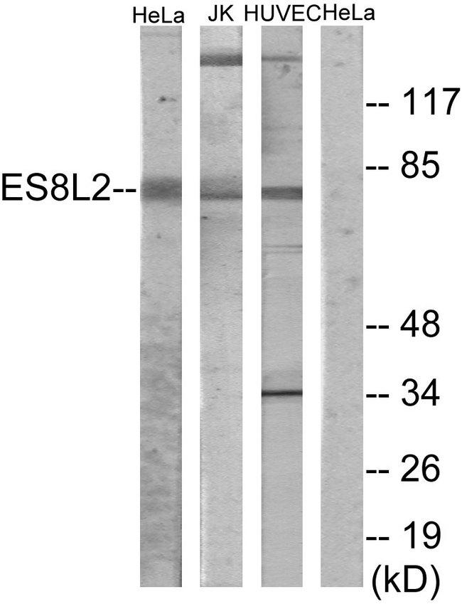 EPS8L2 Antibody - Western blot analysis of extracts from HeLa cells, Jurkat cells and HUVEC cells, using ES8L2 antibody.