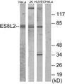 EPS8L2 Antibody - Western blot analysis of extracts from HeLa cells, Jurkat cells and HUVEC cells, using ES8L2 antibody.
