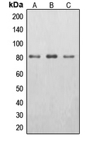 EPS8L2 Antibody - Western blot analysis of EPS8L2 expression in HepG2 (A); HeLa (B); A431 (C) whole cell lysates.