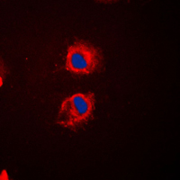 EPS8L2 Antibody - Immunofluorescent analysis of EPS8L2 staining in HeLa cells. Formalin-fixed cells were permeabilized with 0.1% Triton X-100 in TBS for 5-10 minutes and blocked with 3% BSA-PBS for 30 minutes at room temperature. Cells were probed with the primary antibody in 3% BSA-PBS and incubated overnight at 4 C in a humidified chamber. Cells were washed with PBST and incubated with a DyLight 594-conjugated secondary antibody (red) in PBS at room temperature in the dark. DAPI was used to stain the cell nuclei (blue).