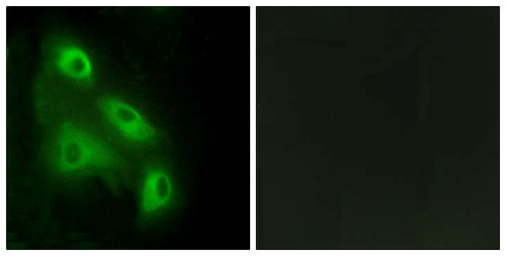EPS8L3 Antibody - Immunofluorescence analysis of HeLa cells, using EPS8L3 Antibody. The picture on the right is blocked with the synthesized peptide.