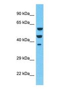 EPS8L3 Antibody - Western blot of EPS8L3 Antibody with human NCI-H226 Whole Cell lysate.  This image was taken for the unconjugated form of this product. Other forms have not been tested.