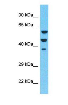 EPS8L3 Antibody - Western blot of EPS8L3 Antibody with human NCI-H226 Whole Cell lysate.  This image was taken for the unconjugated form of this product. Other forms have not been tested.