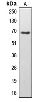 EPS8L3 Antibody - Western blot analysis of EPS8L3 expression in U251MG (A) whole cell lysates.