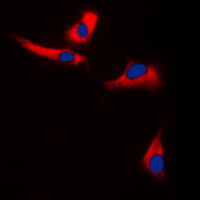 EPS8L3 Antibody - Immunofluorescent analysis of EPS8L3 staining in U251MG cells. Formalin-fixed cells were permeabilized with 0.1% Triton X-100 in TBS for 5-10 minutes and blocked with 3% BSA-PBS for 30 minutes at room temperature. Cells were probed with the primary antibody in 3% BSA-PBS and incubated overnight at 4 C in a humidified chamber. Cells were washed with PBST and incubated with a DyLight 594-conjugated secondary antibody (red) in PBS at room temperature in the dark. DAPI was used to stain the cell nuclei (blue).