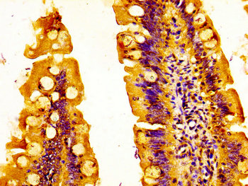EPS8L3 Antibody - Immunohistochemistry image at a dilution of 1:500 and staining in paraffin-embedded human small intestine tissue performed on a Leica BondTM system. After dewaxing and hydration, antigen retrieval was mediated by high pressure in a citrate buffer (pH 6.0) . Section was blocked with 10% normal goat serum 30min at RT. Then primary antibody (1% BSA) was incubated at 4 °C overnight. The primary is detected by a biotinylated secondary antibody and visualized using an HRP conjugated SP system.