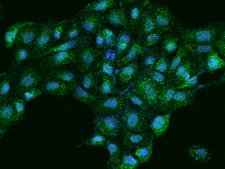 EPS8L3 Antibody - Immunofluorescence staining of EPS8L3 in U2OS cells. Cells were fixed with 4% PFA, permeabilzed with 0.1% Triton X-100 in PBS, blocked with 10% serum, and incubated with rabbit anti-Human EPS8L3 polyclonal antibody (dilution ratio 1:200) at 4°C overnight. Then cells were stained with the Alexa Fluor 488-conjugated Goat Anti-rabbit IgG secondary antibody (green) and counterstained with DAPI (blue). Positive staining was localized to Cytoplasm.