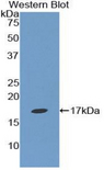 Epsin 1 / EPN1 Antibody - Western blot of recombinant Epsin 1 / EPN1.