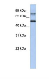 Epsin 1 / EPN1 Antibody - Fetal lung lysate. Antibody concentration: 1.0 ug/ml. Gel concentration: 12%.  This image was taken for the unconjugated form of this product. Other forms have not been tested.