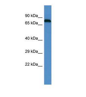 Epsin 1 / EPN1 Antibody - Western blot of Human PANC1. EPN1 antibody dilution 1.0 ug/ml.  This image was taken for the unconjugated form of this product. Other forms have not been tested.