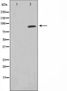 Epsin 1 / EPN1 Antibody - Western blot analysis on K562 cell lysates using EPN1 antibody. The lane on the left is treated with the antigen-specific peptide.