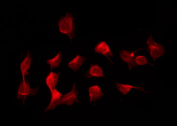 Epsin 1 / EPN1 Antibody - Staining K562 cells by IF/ICC. The samples were fixed with PFA and permeabilized in 0.1% Triton X-100, then blocked in 10% serum for 45 min at 25°C. The primary antibody was diluted at 1:200 and incubated with the sample for 1 hour at 37°C. An Alexa Fluor 594 conjugated goat anti-rabbit IgG (H+L) Ab, diluted at 1/600, was used as the secondary antibody.