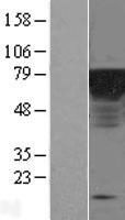 Epsin 1 / EPN1 Protein - Western validation with an anti-DDK antibody * L: Control HEK293 lysate R: Over-expression lysate