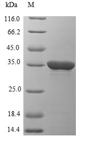 EBV EBNA-1 Protein - (Tris-Glycine gel) Discontinuous SDS-PAGE (reduced) with 5% enrichment gel and 15% separation gel.