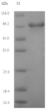 EBV (strain B95-8) GP350 Protein - (Tris-Glycine gel) Discontinuous SDS-PAGE (reduced) with 5% enrichment gel and 15% separation gel.