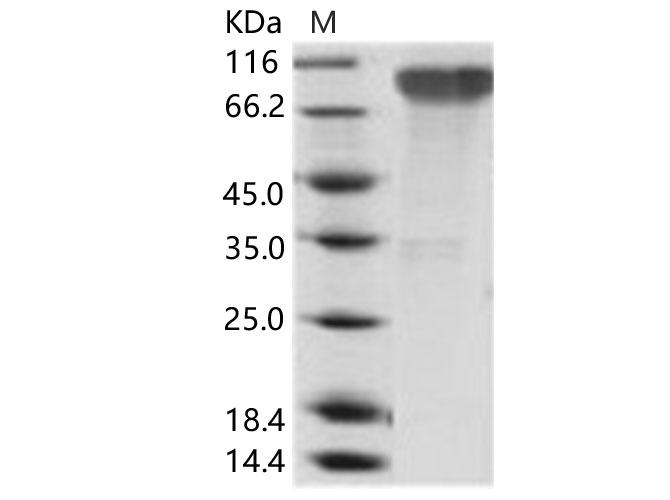 EBV (strain B95-8) GP350 Protein - Recombinant Epstein-Barr virus (Herpesvirus 4) EBV Glycoprotein gp350 / EBV GP350 Protein (His Tag)